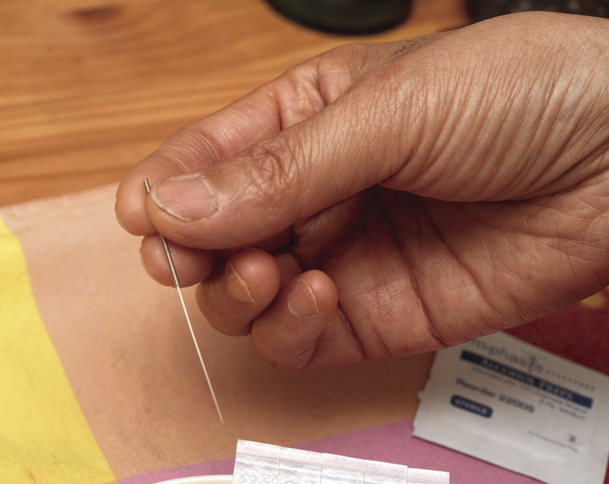 acupuncture 3_CMYK.jpg